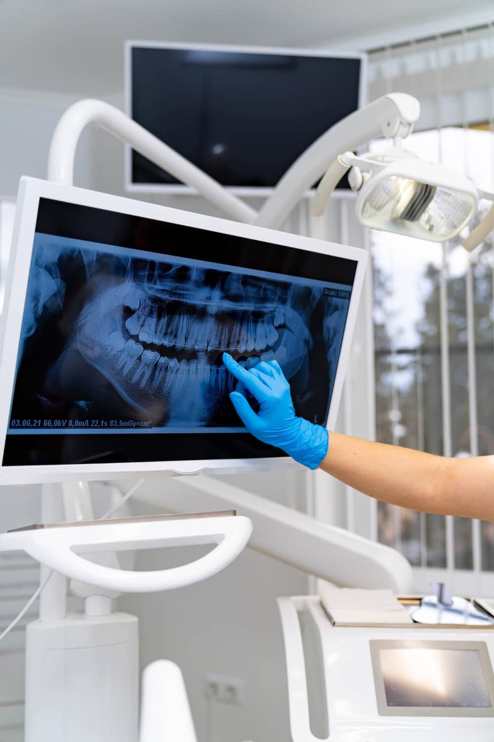 Radiografía en la pantalla de una clínica dental